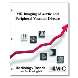 MR Imaging of Aortic and Peripheral Vascular Disease