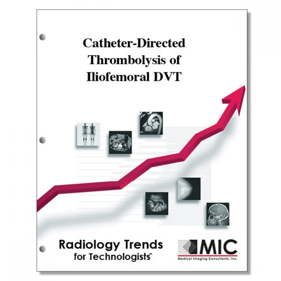 CatheterDirected Thrombolysis of Iliofemoral DVT Medical Imaging Consultants, Inc.