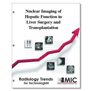 Nuclear Imaging of Hepatic Function in Liver Surgery and Transplantation