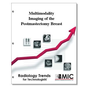 Multimodality Imaging of the Postmastectomy Breast