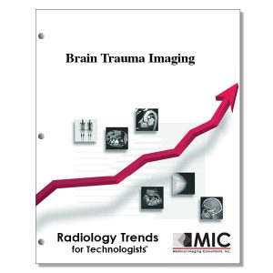 Brain Trauma Imaging